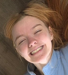Nachher: ein strahlendes Lächeln
